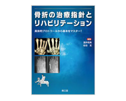 「骨折の治療指針とリハビリテーション：具体的プロトコールから基本をマスター!」