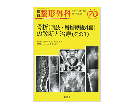 「別冊整形外科　No.70 骨折（四肢・脊椎脊髄外傷）の診断と治療（その１）」