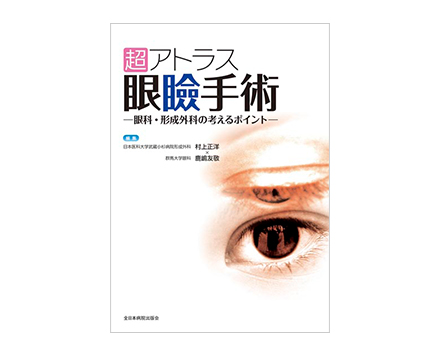 「超アトラス 眼瞼手術～眼科・形成外科の考えるポイント～」